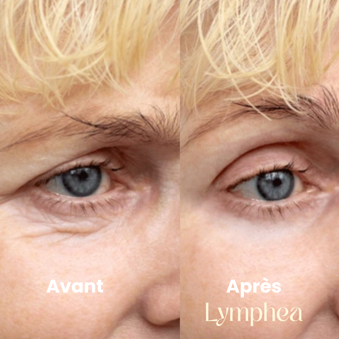 Brosse Lymphea™ - Éclat Naturel