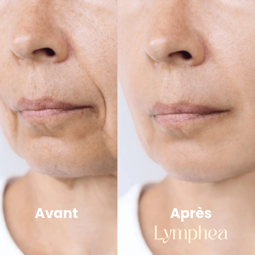 Brosse Lymphea™ - Éclat Naturel