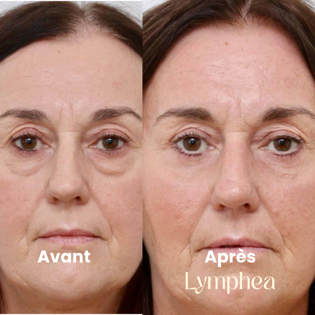 Brosse Lymphea™ - Éclat Naturel